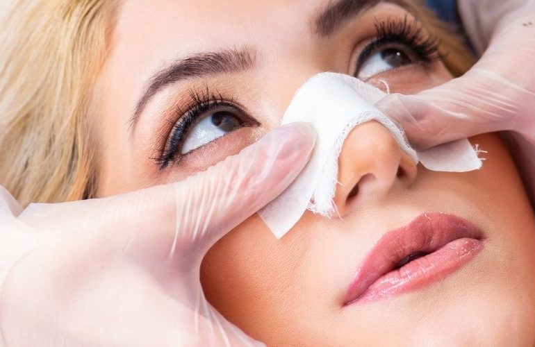 Burun-Ameliyati-Sonrasi-Flaster-Bant-Ne-Ise-Yarar-770x500