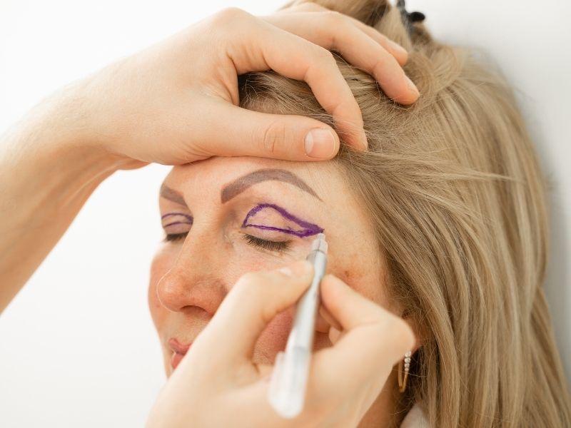 goz-kapagi-estetigi (1)